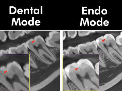 Vatech Smart X CBCT